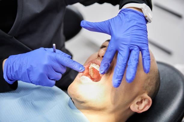 Best Emergency Treatment for Dental Infections or Abscesses in Rockport, IN