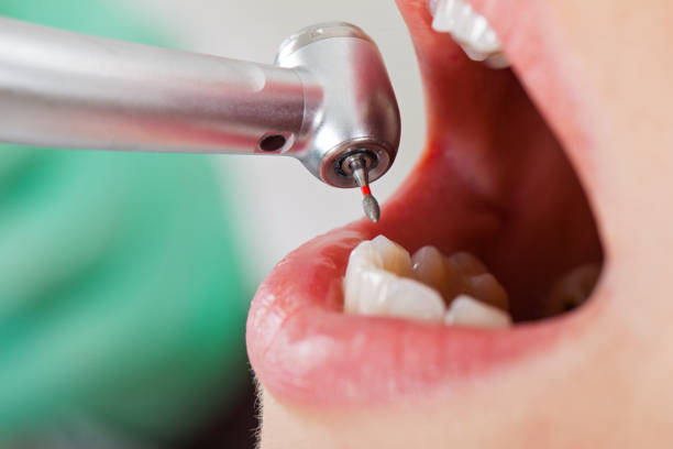 Best Emergency TMJ Treatment in Rockport, IN